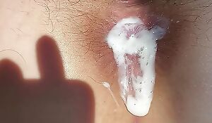 THEY INSERT AN ANAL Buttplug INTO MY Wooly ANAL HOLE Increased by FUCK ME IN Someone's skin ASS. MY ANAL BECOMES CAPACIOUS, WHITE CREAM ASSHOLE.